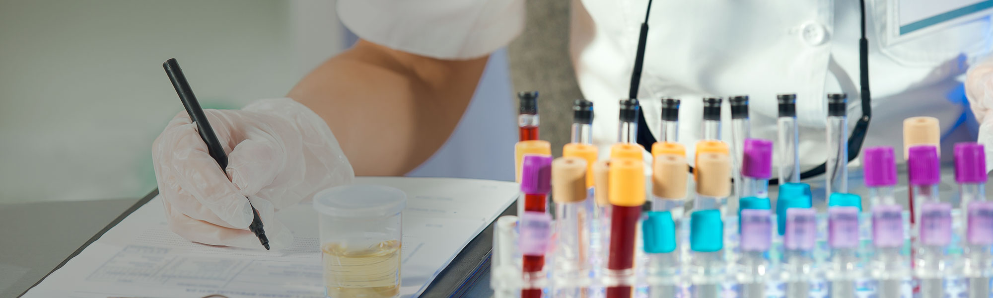 Your source for a drug or alcohol test for employment in Los Alamitos, CA